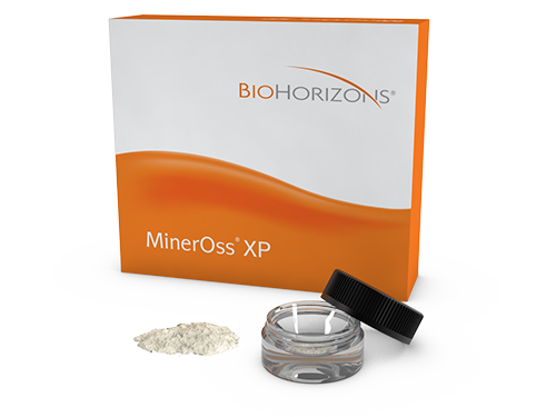 MinerOss-XP Particulate