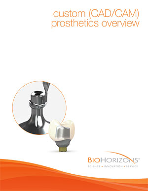 panoramica su protesi (CAD/CAM) personalizzate