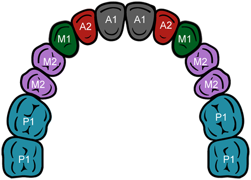 SmartShape Healer maxilla